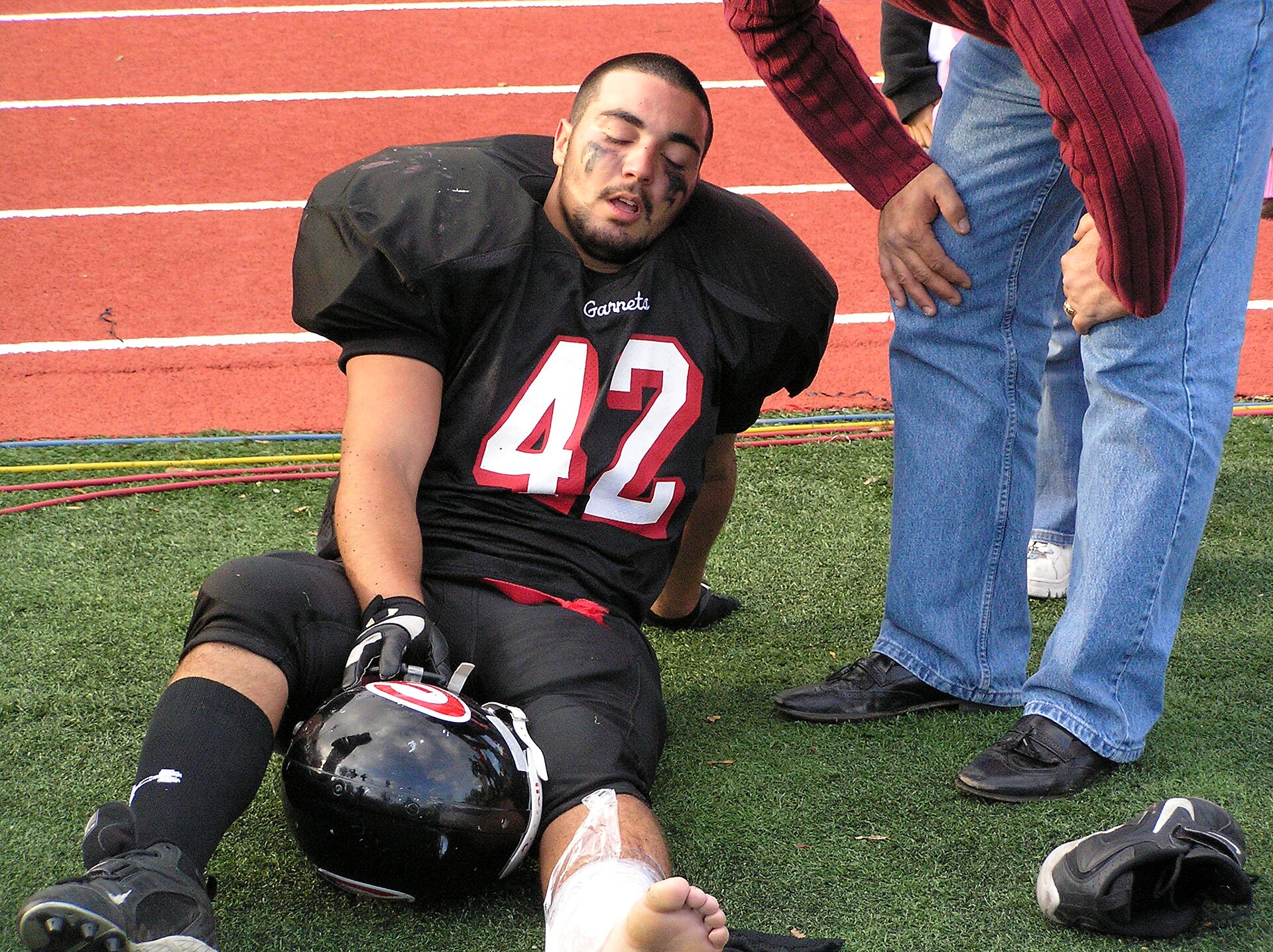 Injured football player being attended to on the field during a match.