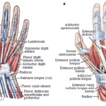 De Quervain tenosynovitis
