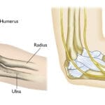 Insights into Olecranon Fractures