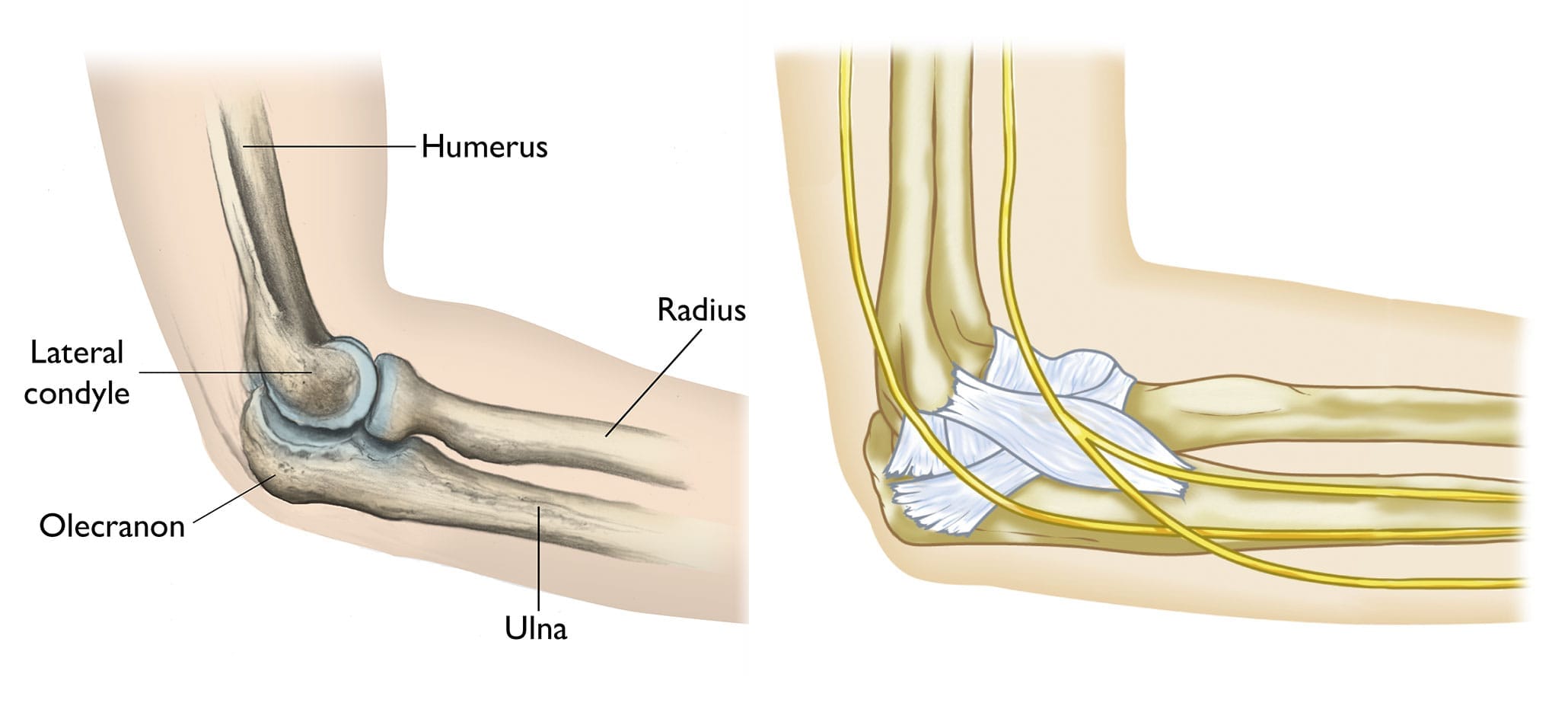 Insights into Olecranon Fractures