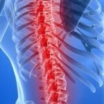 Understanding Anterior Lumbar Interbody Fusion (ALIF) in Spinal Surgery