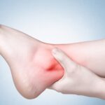 Arthritis of the Foot and Ankle