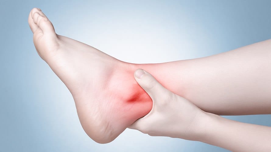Arthritis of the Foot and Ankle