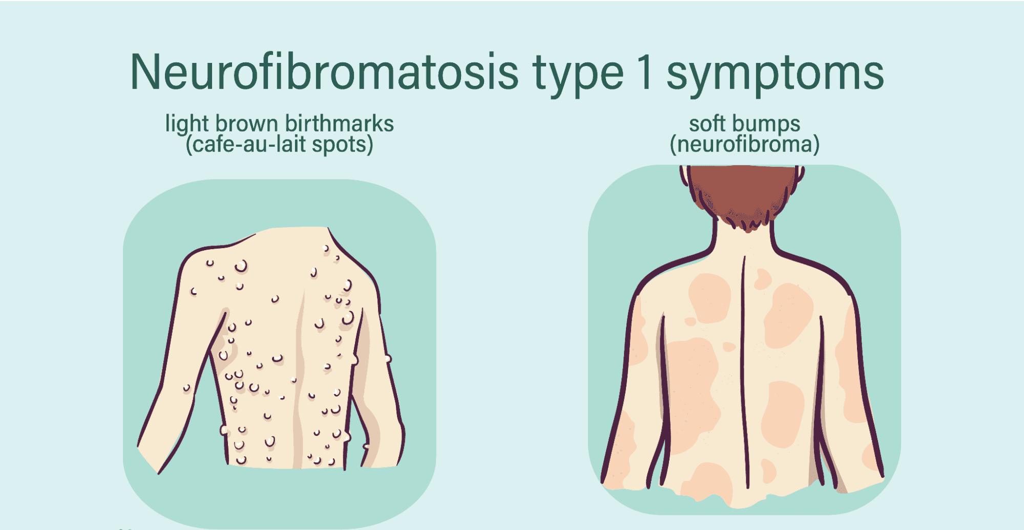 Neurofibromatosis: Understanding, Managing, and Living with the Condition