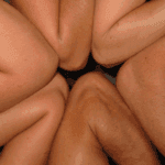 Cubital tunnel syndrome: all you need to know