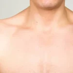 Acromioclavicular Joint Injuries
