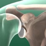 Glenoid Fossa Fractures
