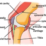 Understanding Anterior Cruciate Ligament (ACL) Injuries