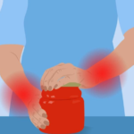 Difficulty Opening Jars? Understanding Basal Joint Arthritis