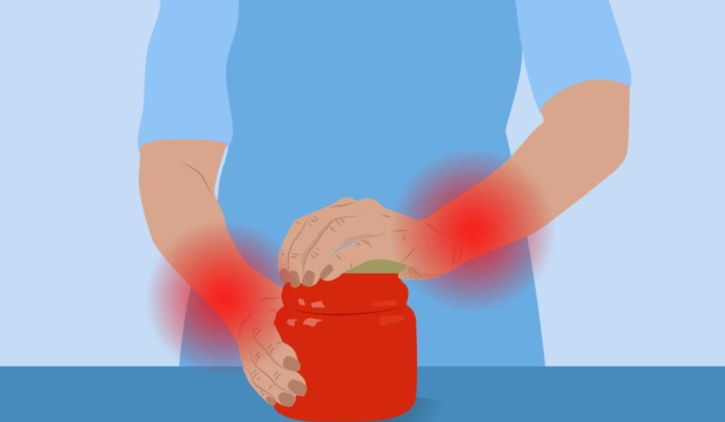 Difficulty Opening Jars? Understanding Basal Joint Arthritis