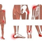 The Essentials of Orthopaedic Surgery
