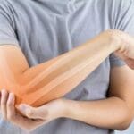 Understanding and Treating Arm Sprains