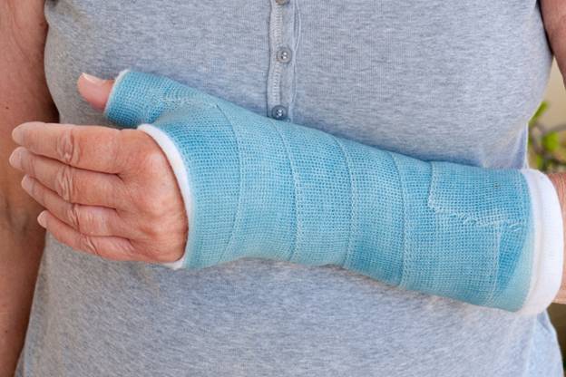 How to Choose the Right Brace for Your Arm Injury: A Comprehensive Guide