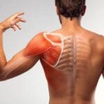 Common Symptoms of a Dislocated Shoulder and What to Do