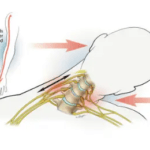 Burners and Stingers