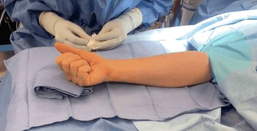 Complications following surgery