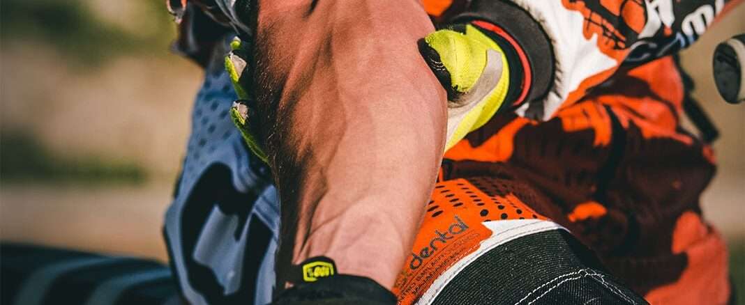 Arm Pump: Chronic Exertional Compartment Syndrome of the Forearm