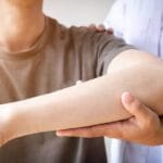 How to Choose the Right Physical Therapist for Your Arm Injury