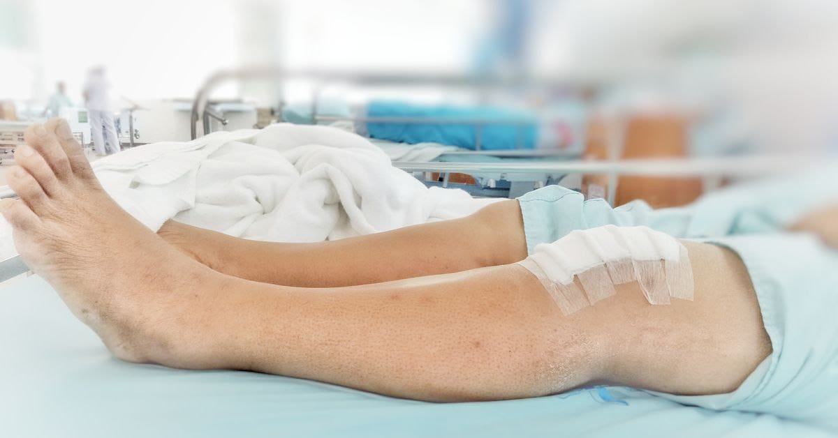 What’s the Best Way To Sleep After Meniscus Surgery?