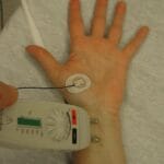 Understanding Electrodiagnostic Testing: EMG and Nerve Conduction Studies Explained