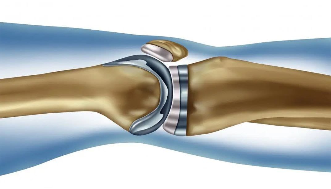 Should I replace the joint and maintain it?