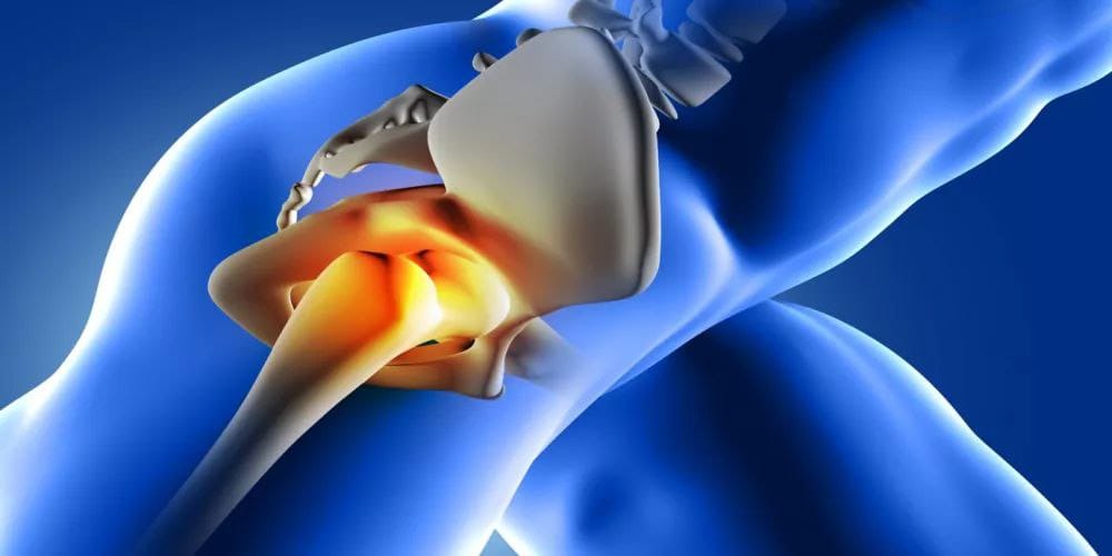 The negative aspects of having two joints