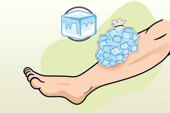 The importance of the type of ice pack you use for the injury