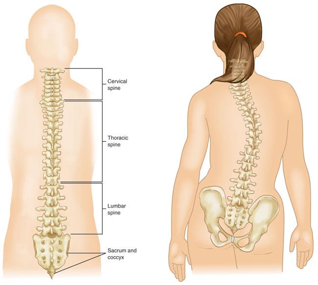 Understanding Neuromuscular Scoliosis in Children with Muscular and Neurological Conditions