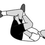 Understanding Snapping Hip Syndrome: Causes, Symptoms, and Potential Complications