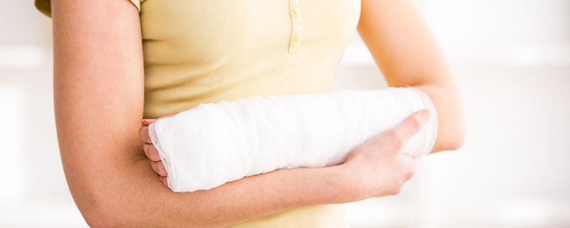 Close-up of a young woman's hand in plaster.