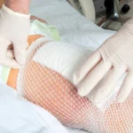 Understanding and Preventing Postsurgical Infections