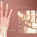 Wrist Anatomy