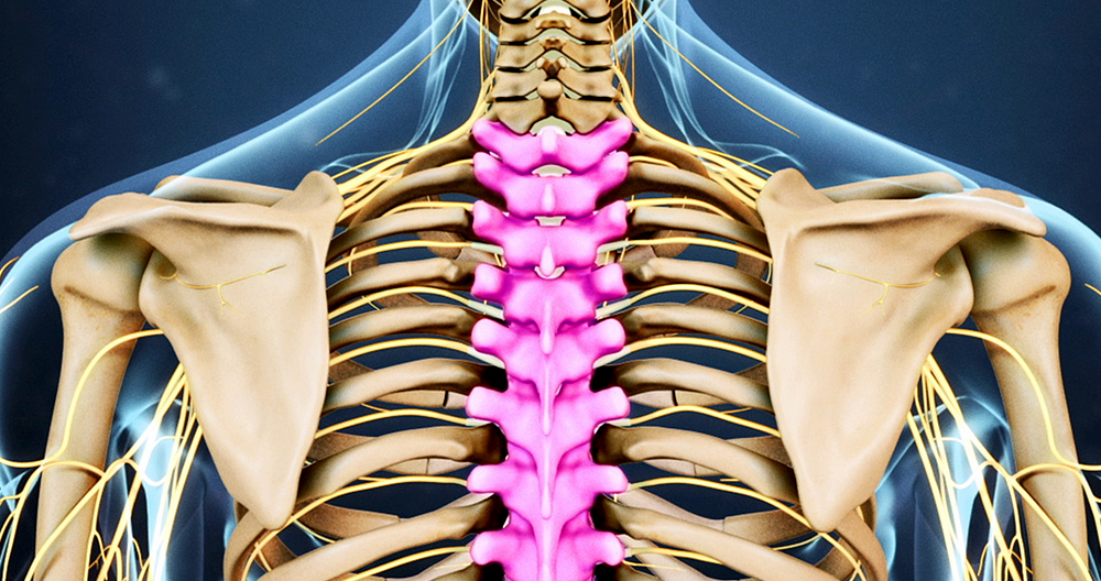 Thoracic Disc Herniation