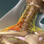 How to Recognize and Treat Nerve Damage in the Arm