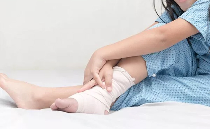Types of Fractures in Children: Causes, Diagnosis, and Treatment