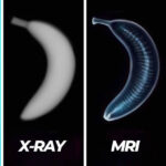 X-ray vs. CT Scan vs. MRI: Key Differences, Uses, and Safety Considerations