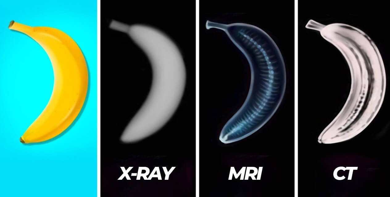 X-ray vs. CT Scan vs. MRI: Key Differences, Uses, and Safety Considerations