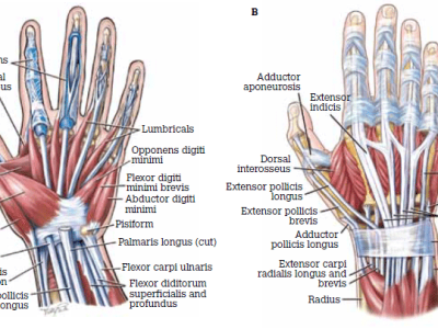 De Quervain tenosynovitis