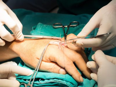 What Is a Hand Surgeon?