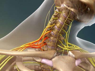How to Recognize and Treat Nerve Damage in the Arm