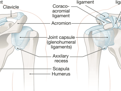 Sternoclaviular Joint Problems
