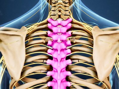 Thoracic Disc Herniation