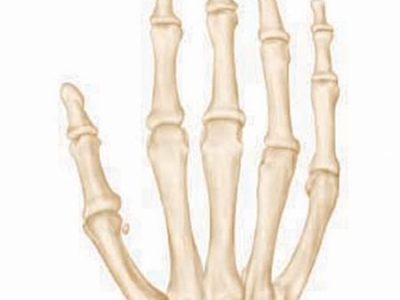 Understanding Osteonecrosis of the Lunate: Causes, Symptoms, and Treatment Options