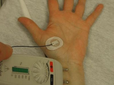 Understanding Electrodiagnostic Testing: EMG and Nerve Conduction Studies Explained