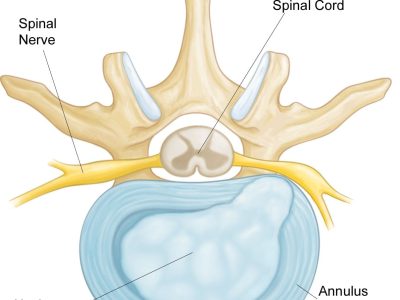 Understanding and Managing Low Back Pain: Causes, Symptoms, and Relief