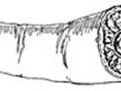 “Restoring Function Through Surgical Reattachment: Understanding Replantation”