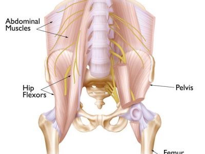 Understanding Hip Strains: Causes, Symptoms, and Treatment Options