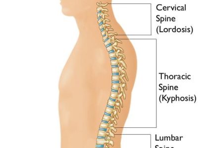Understanding Spinal Kyphosis: Causes, Symptoms, and Treatment Options