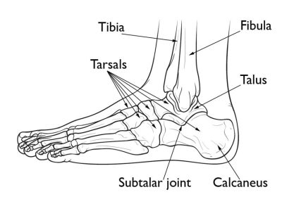 Understanding Calcaneus Fractures: Causes, Treatment, and Long-Term Effects