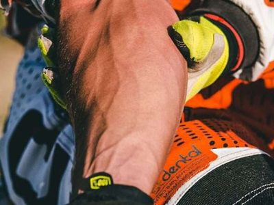 Arm Pump: Chronic Exertional Compartment Syndrome of the Forearm